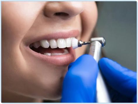 Teeth Cleaning Deep Teeth Cleaning, Dental Veneers, Dental Teeth, Dental Cleaning, General Dentistry, Periodontal Disease, Best Dentist, Dental Services, Cosmetic Dentistry