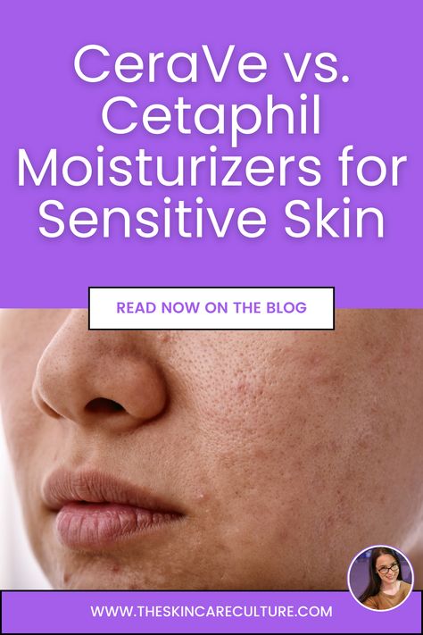 CeraVe vs. Cetaphil: Best Moisturizer for Sensitive Skin Best Moisturizer For Sensitive Skin, Cetaphil Moisturizer, Lanolin Cream, Cerave Moisturizer, Skincare Needs, Different Skin Types, Moisturizer For Sensitive Skin, Congested Skin, Skin Specialist