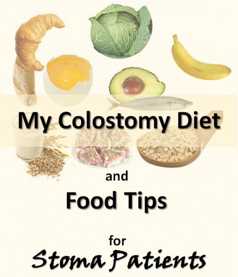 Is there a special colostomy diet for stoma patients? If you have an ostomy, you probably want to know if you have to make major changes to your regular diet, or not. As an ex-colostomy patient, I can only tell you of my experience and the nutritional pattern I followed. Ostomy Life, Ostomy Care, Ostomy Bag, Spicy Food, Diet Guide, Fitness Challenge, Special Diets, Foods To Avoid, Calorie Intake