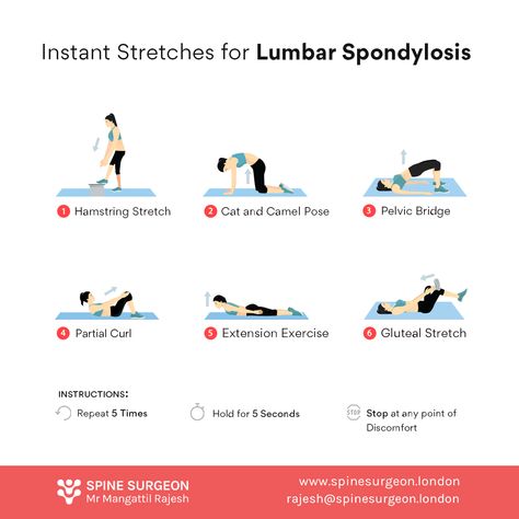 6 Stretches for Lumbar Spondylosis  These are six easy and quick back pain exercises for lumbar spondylosis that help to stretch your muscles, ligaments around the spine. It improves the flexibility, strength and function of your back. Gentle and regular exercises will prevent back pain in the future.  Please take adequate precautions and pain killers before these exercises. Stop immediately when the pain worsens. Lumbar Exercises, Lumbar Spondylosis, Mckenzie Exercises, Lumbar Lordosis, Forward Head Posture Exercises, Exercises For Strength, Spine Care, Body Workout Routine, Lumbar Pain