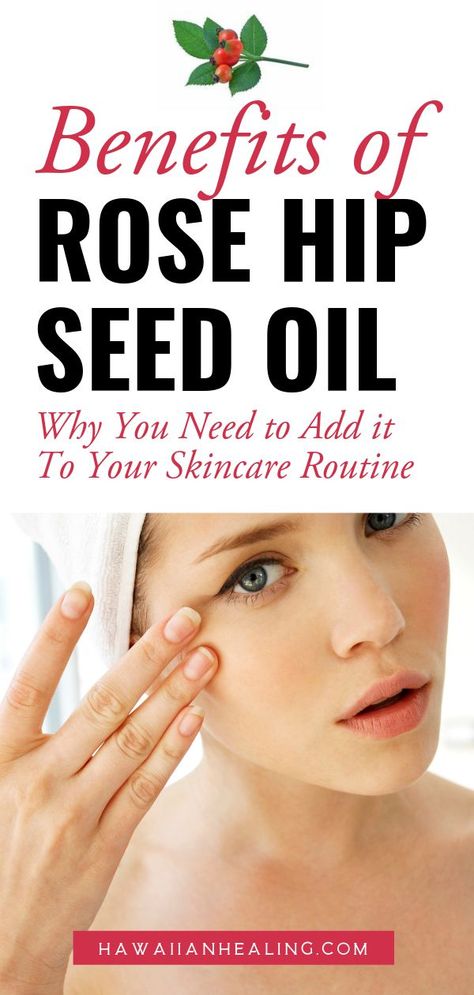 Rose Hip Oil Benefits Skin Care, Rose Hip Seed Oil Benefits, Rosehip Oil Benefits, Rose Hip Seed Oil, Cleopatra Beauty Secrets, Healing Skin, Rose Hip Oil, About Rose, Diy Rose