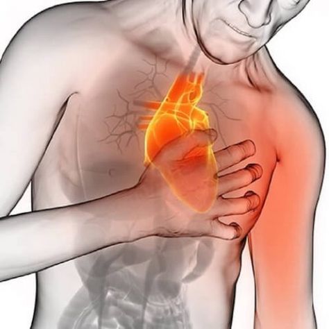 5 Signs of Recognizing a Heart Attack One Month Before It Actually Happens Heart Problems, Full Body Massage, Sciatica, Alzheimers, Health Facts, Lifestyle Changes, Warning Signs, One Month, Omega 3