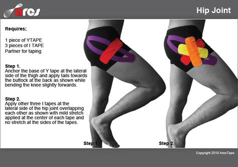 Hip Joint Kt Tape Hamstring, Kt Tape Hip Flexor, Kt Tape Hip, Hip Health, Hip Dislocation, Sore Hips, K Tape, Bursitis Hip, Kinesio Tape