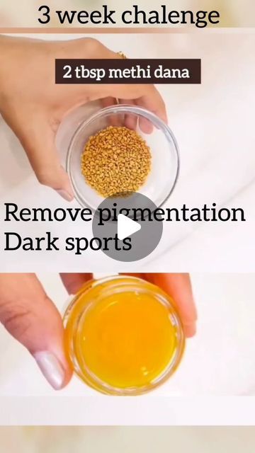 Remedies For Pigmentation On Face, Face Beauty Tips Skin Care, How To Remove Pigmentation On Face, Face Pigmentation Remedies, Dark Skin Around Neck, Pigmentation On Face, Pigmentation Remedy, Skincare Remedies, Best Night Cream