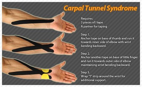 Carpal Tunnel Exercises, Carpel Tunnel, Carpal Tunnel Relief, K Tape, Nyttige Tips, Kinesio Tape, Kt Tape, Kinesio Taping, Kinesiology Taping