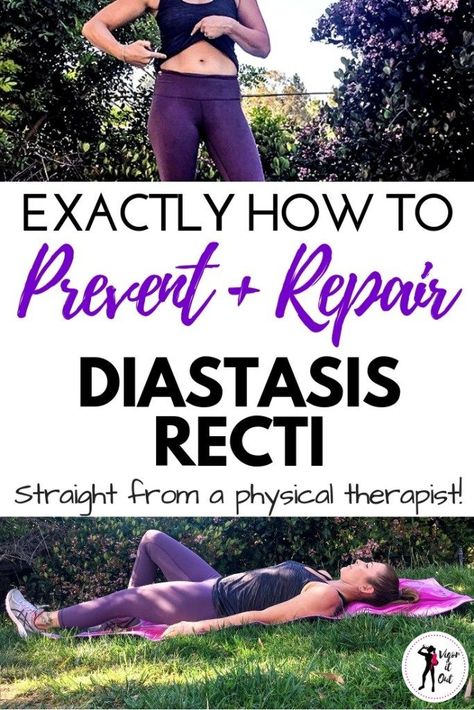 Learn all about diastasis recti repair postpartum and prevention for during pregnancy straight from a physical therapist. These healing physical therapy exercises help with abdominal separation to heal your belly after baby. It is so important to start your postpartum workout plan off right! Postpartum recovery should begin in your core. #diastasisrecti #postpartumrecovery #postpartumworkout #afterbaby Diastasis Recti While Pregnant, Diastasis Recti Exercises While Pregnant, Pregnancy Weight Lifting, Prenatal Exercises, Pregnancy Abs, Postpartum Abs, Diastasis Recti Repair, Prenatal Fitness, Postpartum Workout Plan