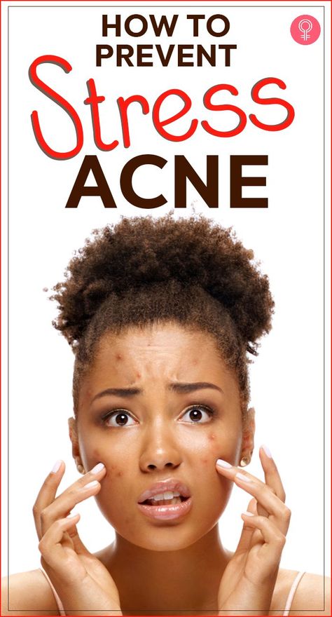 skinacne. woman with face acne. woman with acne. stressed out woman with acne. Anti Acne Skin Care, Back Acne Remedies, Acne Help, Skin Aesthetics, Losing 40 Pounds, Severe Acne, Acne Causes, Natural Sleep Remedies, Acne Facial