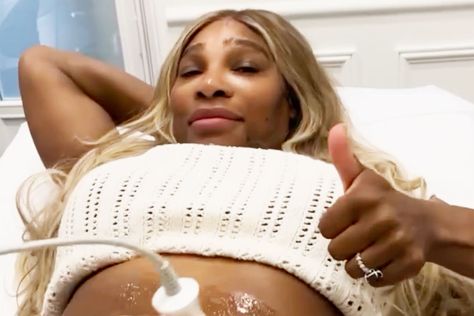 Serena Williams Reveals Tummy-Tightening Procedure but Says 'I Will Always Love My Birthing Scars' Tummy Tightening, Skin Tightening Procedures, Emergency C Section, Skin Tightening Treatments, Beauty Procedures, Tennis Champion, Cleveland Clinic, Never Be The Same, Post Pregnancy