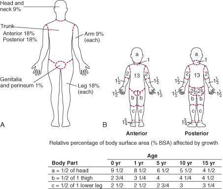 Table: (A) Rule of nines (for adults) and (B) Lund-Browder chart (for children) for estimating extent of burns - MSD Manual Professional Edition Rule Of Nines, Treat Burns, Education Certificate, Board Exam, Wound Care, Medical Knowledge, Life Improvement, Head And Neck, Physical Therapy