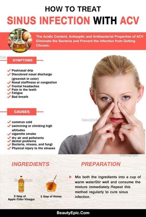 How to Use Apple Cider Vinegar for Sinus Infection Treating Sinus Infection, Sinus Remedies, Apple Cider Vinegar Remedies, Cider Vinegar Benefits, Sinus Infection Remedies, Apple Cider Vinegar Benefits, Apple Cider Vinegar Drink, Allergy Remedies, Sinus Infection