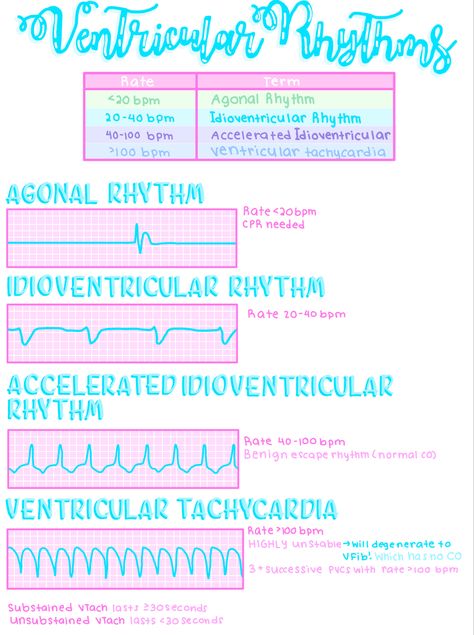 EKGs Ekg Technician Aesthetic, Nursing Cardiovascular, Medical Study Notes, Ekg Tech, Med School Study, Aesthetic Medical, Nurse Skills, Ekg Interpretation, Nurse Teaching