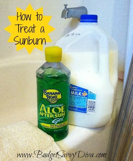 How to Treat a Sunburn Natural Remedies For Acne, Remedies For Acne, Sunburn Remedies, Sunburn Relief, Fabric Softener Sheets, Neat Tricks, Homemade Remedies, Beauty Recipe, Acne Skin