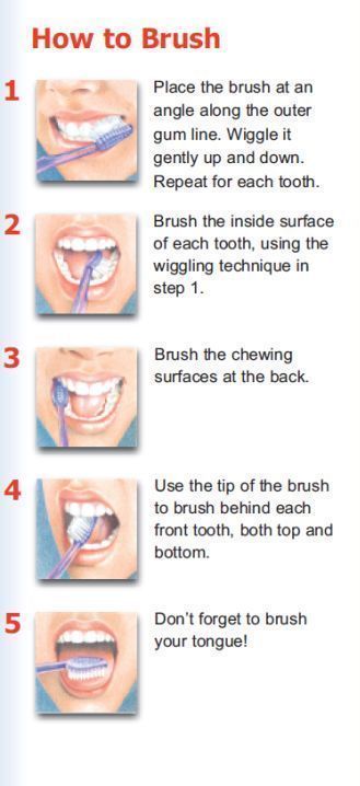 How to brush your teeth? Don't be surprised... We have to teach patients the proper technique everyday. It is important to use proper technique using soft strokes and a soft bristle brush. Harder is not better. If you don't want recession that is! Don't forget to massage the gums lightly and brush your tongue! #oralhygiene Brushing Your Teeth, Sikat Gigi, Brush Your Teeth, Oral Care Routine, Gum Care, Teeth Care, Oral Health Care, Bristle Brush, Dental Hygiene