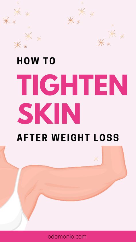 Tighten Skin Loose Skin Removal Before And After, How To Get Rid Of Loose Skin, Weight Training For Beginners, Tighten Loose Skin, Extra Skin, Excess Skin, Saggy Skin, Loose Skin, Toning Workouts