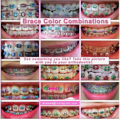 Color combinations Rainbow Braces, Braces Colors Combinations, Invisible Teeth Braces, Braces Retainer, Pink Braces, Kawat Gigi, Natural Teeth Whitening Diy, Cute Braces Colors, Braces Tips