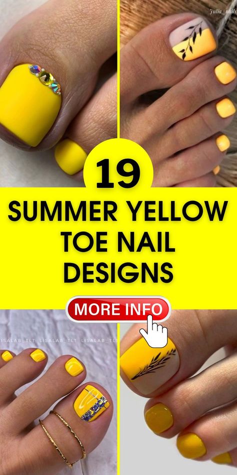 Yellow Toe Nail Designs, Bright Toe Nails, Neon Pedicure, Yellow Toe Nails, Toenail Designs Summer, Almond Gel Nails, Nail Color Combos, Pedicure Ideas, Summer Toes