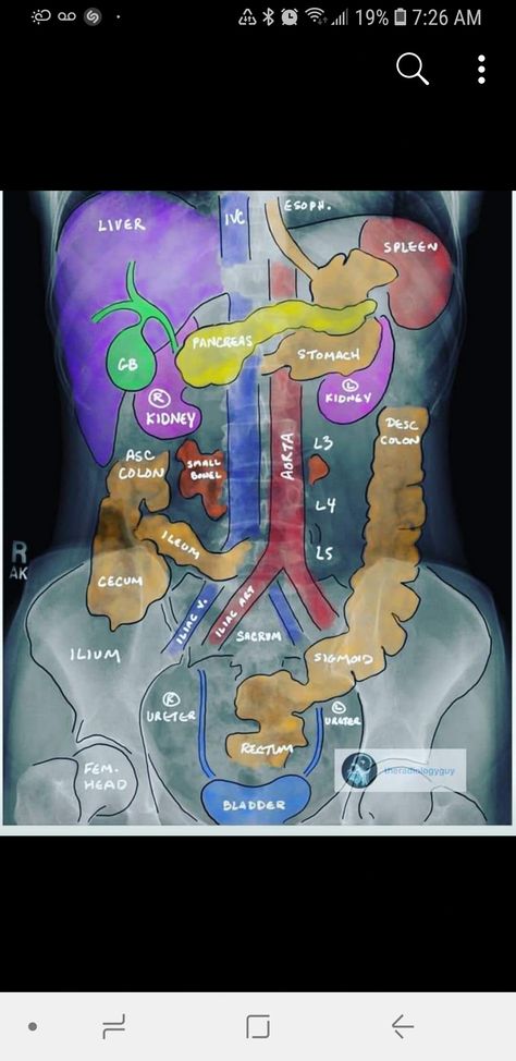 Assistant Aesthetic, Diagnostic Medical Sonography Student, Simple Nursing, Medical Radiography, Medical Terminology Study, Sonography Student, Radiology Student, Basic Anatomy, Diagnostic Medical Sonography