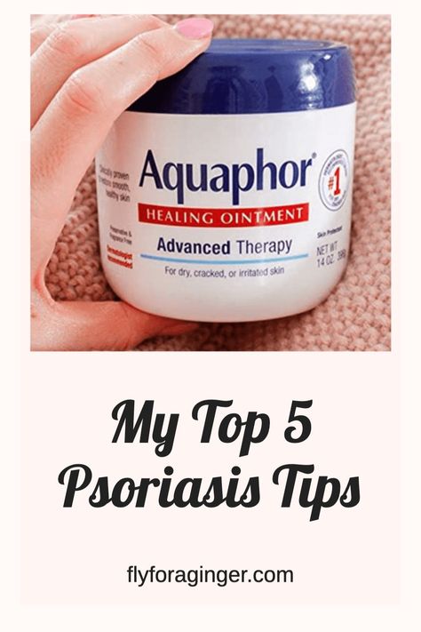 Tips for dealing with psoriasis #psoriasis #dryskin #skinremedies #itchyskin Psiorasis Diet, Psoriatic Skin Remedies Diy, Scalp Psiorasis, Psoriatic Skin Natural Remedies, Psoriatic Scalp Remedies, Psoriatic Skin Diet, Psoriatic Skin Remedies, Psoriatic Scalp, Psoriatic Skin