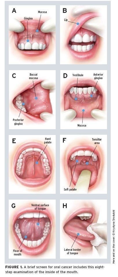 Dental Assistant Study Guide, Dental Assistant School, Dental Hygienist School, Dental Assistant Study, Dental Hygiene Student, Dental World, Dental Hygiene School, Dentistry Student, Dental Anatomy