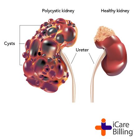 Diet Schedule, Polycystic Kidneys, Constant Headaches, Healthy Kidneys, Healthy Living Inspiration, Healthy Living Motivation, Liver Diet, Kidney Cleanse, Healthy Morning Routine