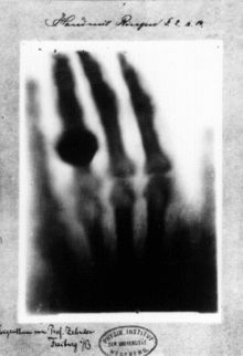 Clarence Dally — The Man Who Gave Thomas Edison X-Ray Vision. read more at smithsonianmag.com | History | Technology | Innovation | Amazing People | Hand With Ring, X Ray Tube, X-ray Images, Invisible Hand, Nuclear Medicine, Medical Imaging, 22 December, Marie Curie, Blog Images