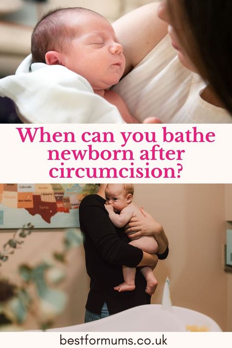 When Can you Bathe Newborn After Circumcision? When To Bathe Newborn, Circumcision Care Newborn, Strong Willed Child, Baby Gift Guide, Delivering A Baby, Sibling Rivalry, In Hospital, Common Questions, Baby Led Weaning