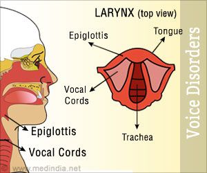 Voice Disorders Voice Anatomy, Voice Dysphoria, Voice Disorders, How To Get Rid Of Hoarse Voice, Tone Of Voice Examples, Grad Student, Speech Pathology, Muscle Tension, Wellness Fitness