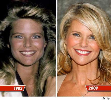 Natural Skin Care .... Chatter Busy: Christie Brinkley Plastic Surgery ? Christie Brinkley Plastic Surgery, Plastic Surgery Facts, Natural Aging Skin Care, Plastic Surgery Photos, Facial Surgery, Facial Plastic Surgery, Celebrity Plastic Surgery, Christie Brinkley, Reconstructive Surgery