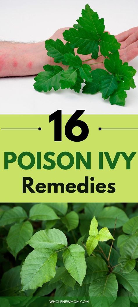 Learn How To Treat Poison Ivy Rash Quickly and Effectively with Natural Products you have at Home. See how to get rid of Poison Ivy Itch fast with baking soda, apple cider vinegar and many more. SO much better than store bought remedies. Poison Ivy Home Remedies, Remedies For Poison Ivy, Ant Remedies, Poison Ivy Leaves, Poison Ivy Remedies, Medical Remedies, Poison Ivy Rash, Rosemary Gladstar, Outdoor Hacks