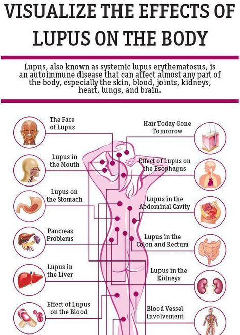 Autoimmune Disease Symptoms, Heart Lungs, Alkaline Diet, Autoimmune Disorder, Health Journey, Autoimmune Disease, Health Info, Lungs, Mediterranean Diet