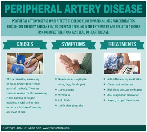 Peripheral Vascular Disorders, Peripheral Arterial Occlusive Disease, Pad Nursing, Disease Infographic, Peripheral Artery, Unclog Arteries, Legs Exercise, High Blood Pressure Medication, Nursing Study Tips