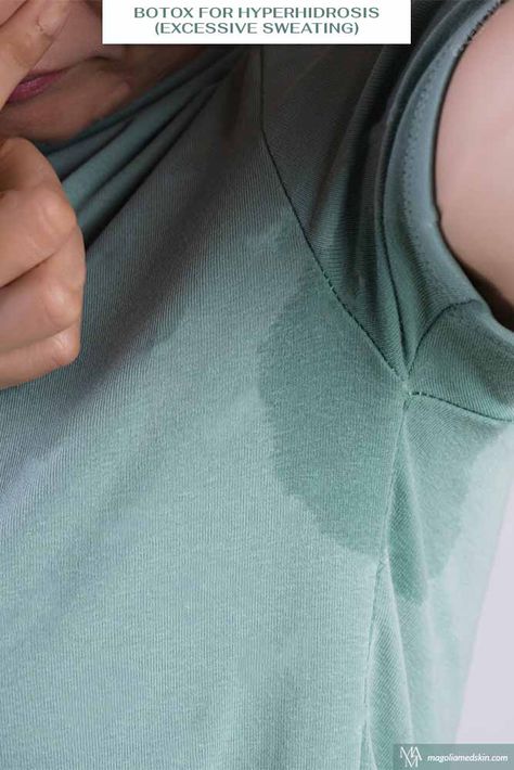 BOTOX For Hyperhidrosis (Excessive Sweating) https://www.magnoliamedskin.com/botox-for-hyperhidrosis-excessive-sweating/?utm_source=buffer&utm_medium=Social&utm_campaign=SocialWarfare. #excessivesweating can be embarrassing 🫢. #botoxforhyperhidrosis can relieve you of this condition. Excessive Underarm Sweating, Pumpkin Facial, Facial Benefits, Botulinum Toxin, Skin Care Pictures, Injectables Fillers, Wrinkle Reduction, Sweat Gland, Botox Injections