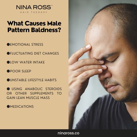 What Causes Male Pattern Baldness? A major contributing factor to male pattern baldness [besides your genes] is when male hormones [like DHT] attack the hair follicles and destroy them. 🤦🏾♂️ Besides this, studies have shown that poor nutrition, smoking, and mental stress also contribute to it. 🙄 So, if you're genetically prone to male pattern baldness, these factors can trigger it. 💎 Visit our website and discover all the solutions for hair loss: ninaross.co Skincare Branding, Poor Nutrition, Male Pattern Baldness, Hair Therapy, Pattern Baldness, Skin Care Clinic, Lean Muscle Mass, Bald Men, Hair Follicles