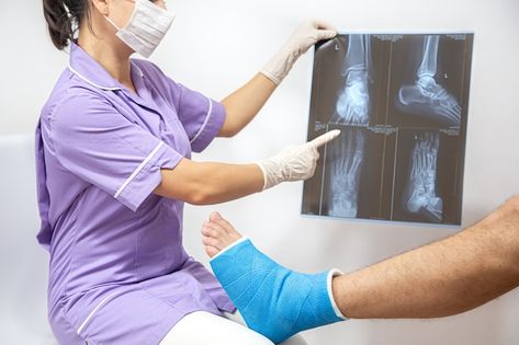 Bone fracture foot and leg on male patie... | Free Photo #Freepik #freephoto #fracture #ankle #bruise #female-nurse Bone Fracture, Knee Replacement Surgery, Bone Diseases, Musculoskeletal System, Orthopedic Surgery, Knee Replacement, Female Doctor, Sports Injury, Sports Medicine