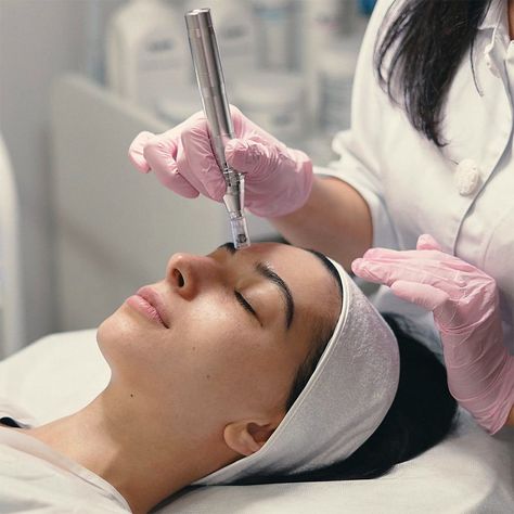 Is Microneedling Safe? Most Common Risks And Benefits Dermapen Microneedling, Facial Therapy, Facial Aesthetics, Aesthetic Clinic, Skin Care Clinic, Glow Skin, Flawless Beauty, Skin Clinic, Skin Care Treatments