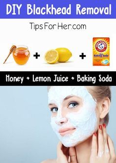 DIY Blackhead Removal Clear Skin Naturally, Blackheads On Nose, Black Heads, Blackhead Removal, Get Rid Of Blackheads, Homemade Diy, Pregnancy Health, Beauty Remedies, Homemade Face Masks