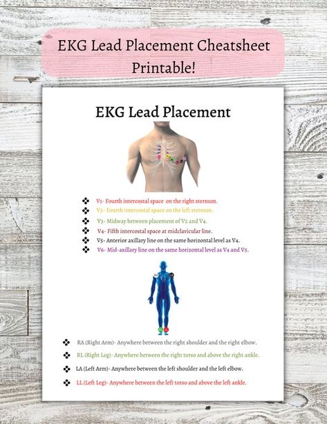 Check out this item in my Etsy shop https://www.etsy.com/listing/1261019308/ekg-lead-placements-printable-cheatsheet Ekg Leads, Study Help, Medical School, School Items, Study Guide, Nursing, Back To School, Medical, Instant Download