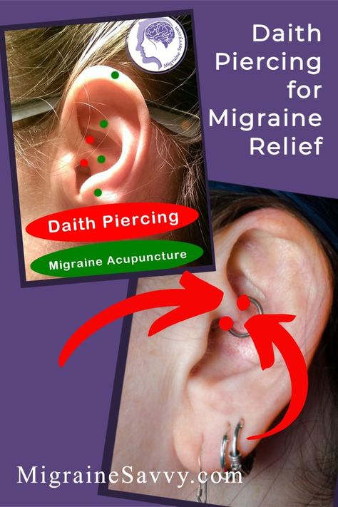 Headache Piercing Earrings, Migraine Relief Piercing, Daith Piercing Jewelry Migraine Relief, Migraine Ear Piercing, Migrene Piercing, Piercing For Headaches, Migraine Piercing Earrings, Migraine Piercing Daith, Daith Piercing For Migraines