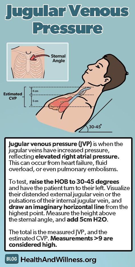 Advanced Physical Exam Maneuvers | Health And Willness Jugular Venous Pressure, Medical Student Study, Cardiac Nursing, Nursing School Survival, Nursing School Notes, Medical School Studying, Medical School Essentials, Health And Fitness Magazine, Nursing Tips