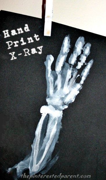 Hand print X-ray Preschool Xray Craft, Human Body Projects, Xray Art, Body Craft, Alphabet Crafts, Group Ideas, Abc Book, Footprint Art, Preschool Letters