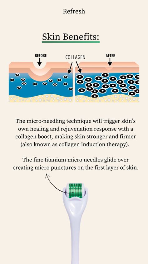 Dermarolling Face, Derma Roller How To Use, Skin Anatomy, Derma Rolling, Sore Muscle, Skin Roller, Micro Needling, Skin Facts, Skin Moles