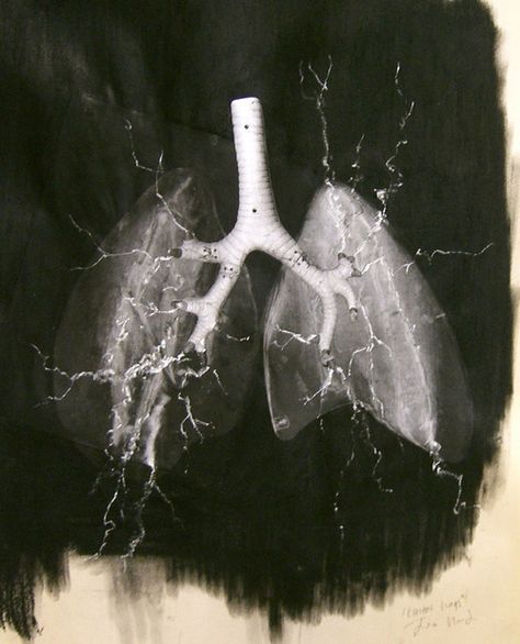 Electric Lungs Lungs Drawing, Lungs Art, Lloyd Jones, Art Movements, Rock Lee, Medical Art, Human Anatomy, Science Art, Lungs