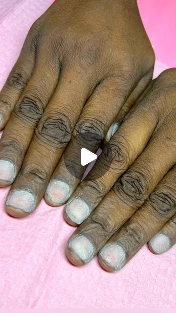 Hand Feet Whitening Tips, How To Get Rid Of Finger Wrinkles, Face Home Remedies Skincare, Dark Knuckles Cream, How To Get Fair Hands, How To Get Rid Of Dark Knuckles On Hands, How To Get Rid Of Hand Wrinkles, How To Remove Dark Knuckles, How To Get Rid Of Wrinkles On Hands