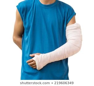 Arm Cast, Dog Meme, Broken Arm, People Person, Orthopedic Surgery, Dog Memes, Health Healthy, Ambulance, Surgery