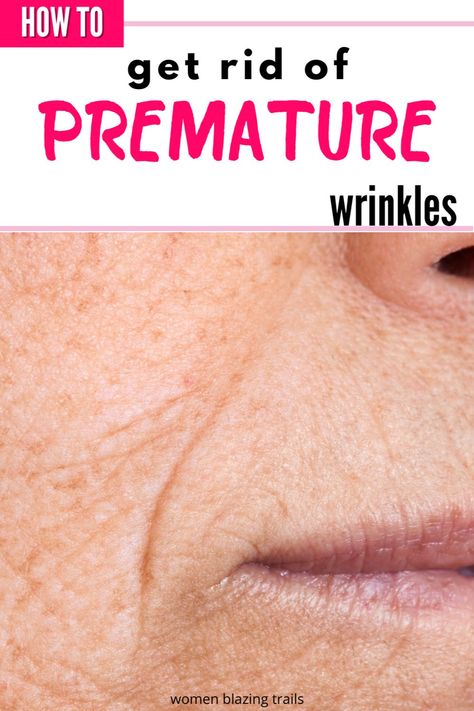 Say goodbye to premature wrinkles! Discover 11 game-changing tips that will help you get your skin looking fresh and young again. From skincare secrets to lifestyle changes, these expert tips will have you flaunting a wrinkle-free complexion in no time.  #womenover50 #wrinkles #prevent #skincare #premature #aging 11 Wrinkles, Premature Wrinkles, Skincare Secrets, Things To Try, Women Inspiration, Inspirational Articles, Midlife Women, Anti Wrinkle Cream, Deep Wrinkles