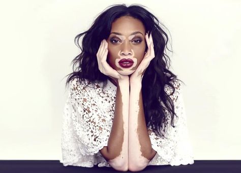 15 Personas con un tono de piel increíble y hermoso Lola Chuil, Chantelle Brown Young, Stephen Thompson, Winnie Harlow, Beautiful Skin, Skin, Instagram