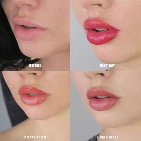 Cosmetic Lip Tattoo, Lip Color Tattoo, Lip Permanent Makeup, Lip Blushing, Lipstick Tattoos, Permanente Make-up, Botox Lips, Permanent Lipstick, Kylie Jenner Lips