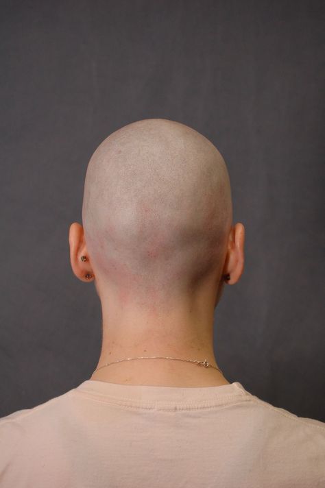 bald woman head back view Bald Head Drawing, Heads In Different Angles, Head Back View, Female Portrait Reference, Practice Drawing Faces, Bald Person, Head References, Head Memes, Skin Anatomy