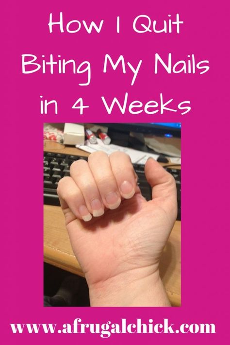 Nail Biting Remedies, Nail Chewing, Biting Fingernails, Bitten Nails, Nail Biting Habit, Biting Nails, Psychology Professor, Nail Remedies, Nails Care