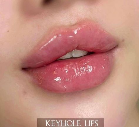 Perfect Lip Filler, Lip Shapes Filler, Lip Filler Russian, Russian Lips Filler Before And After, Perfect Lips Natural, Full Lips Aesthetic, Lip Filler Styles, Keyhole Lips, Lip Filler Inspiration